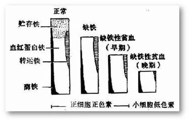 缺铁性贫血吃什么补铁？